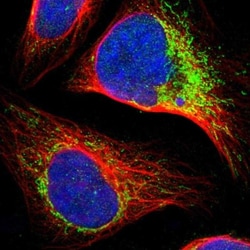CCDC44 Antibody, Novus Biologicals 25 &mu;L; Unlabeled:Antibodies, Polyclonal